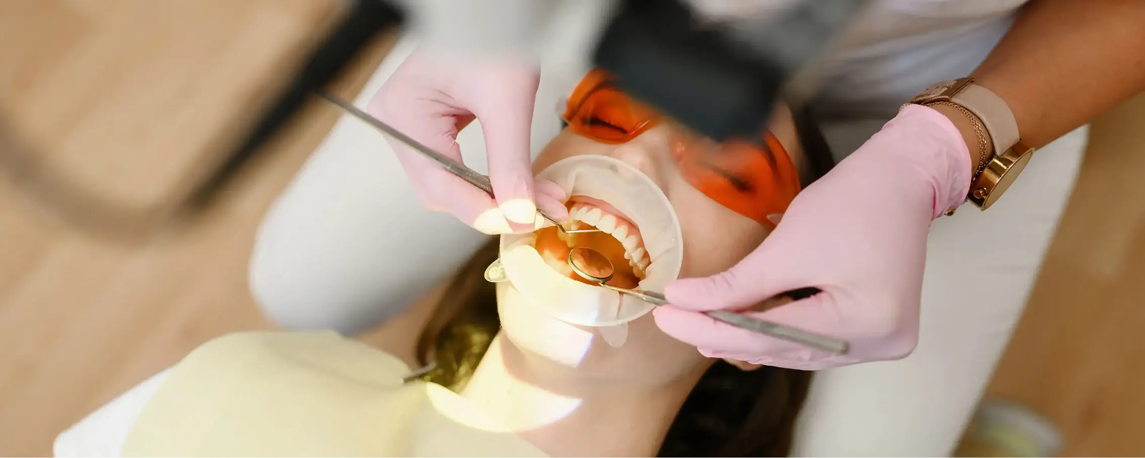 Cosmetic dentistry at Stoke Dental preview